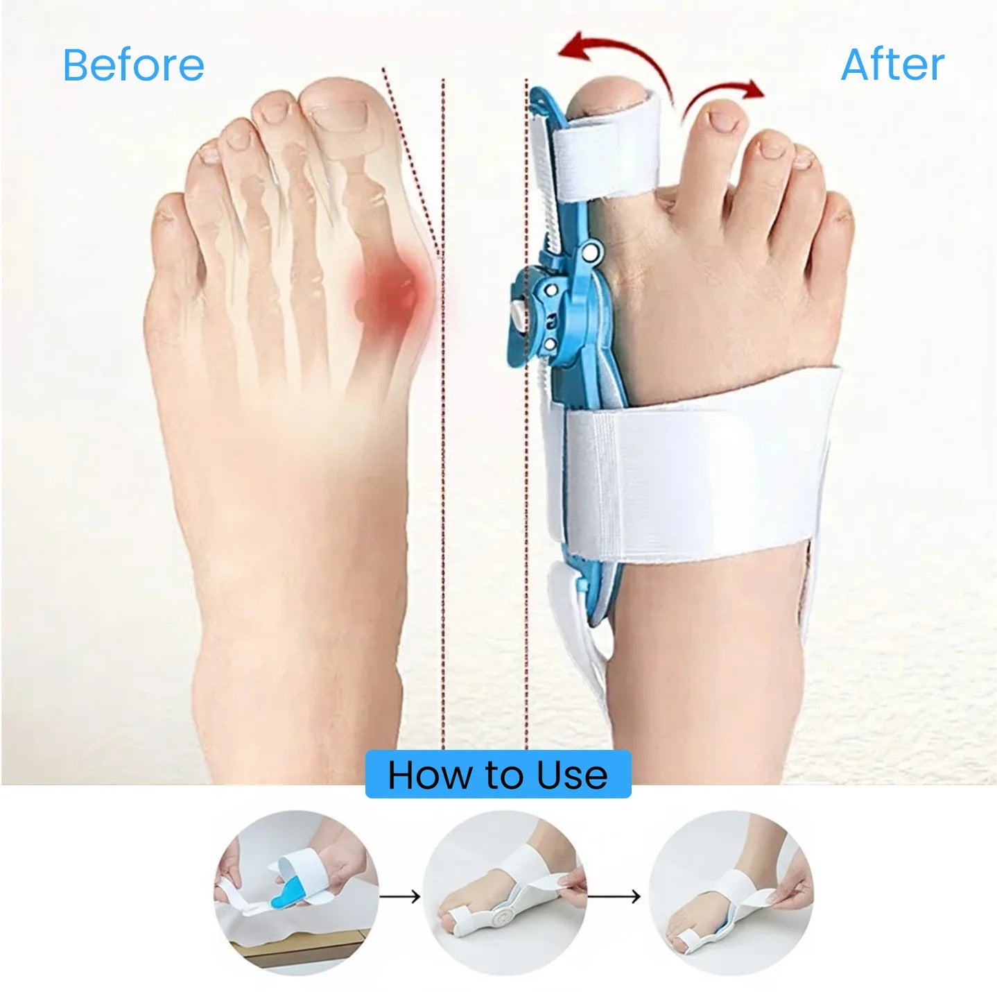 Hallux Valgus Corrector – Toe Realignment Support for Bunion Relief & Foot Comfort