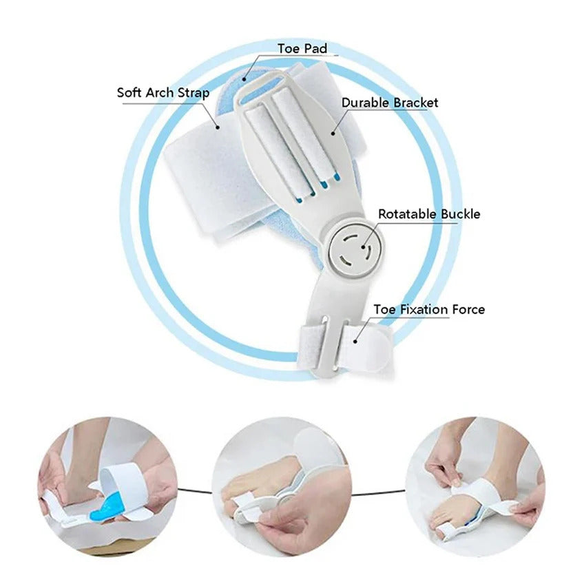 Hallux Valgus Corrector – Toe Realignment Support for Bunion Relief & Foot Comfort