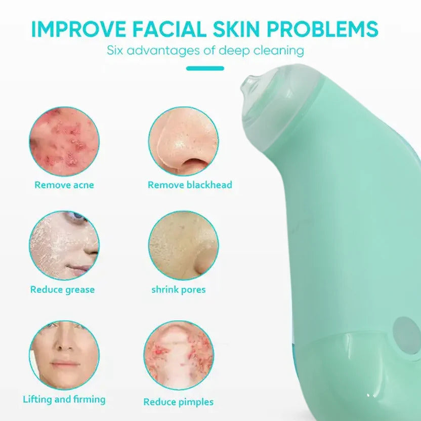 Mini Handheld Vacuum Blackhead Remover for Facial Skin Care – Deep Pore Cleaner